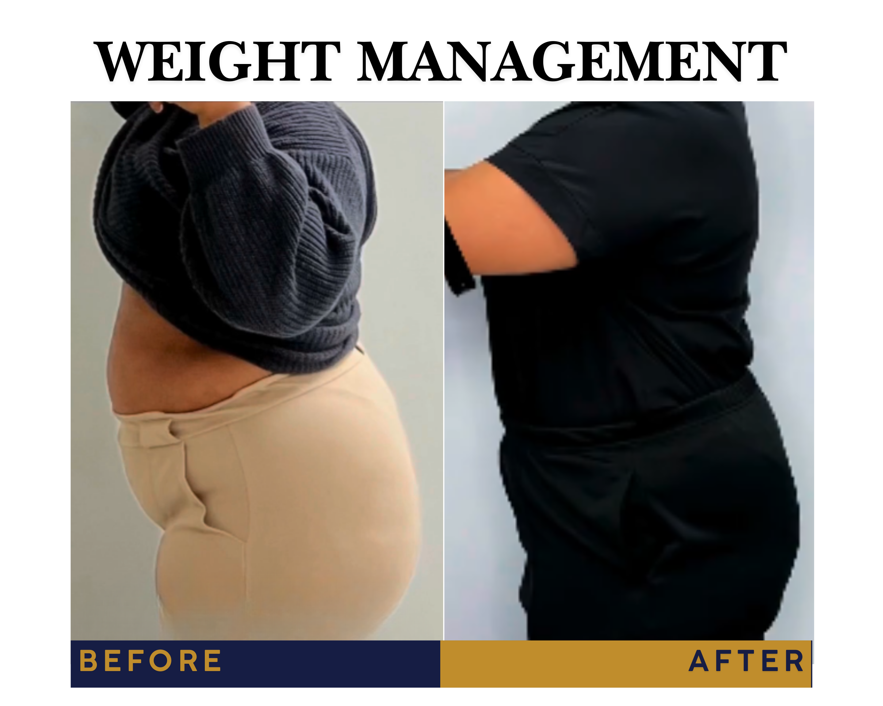 Weight management program before and after result | Jules Aesthetics in Floral Park, NY