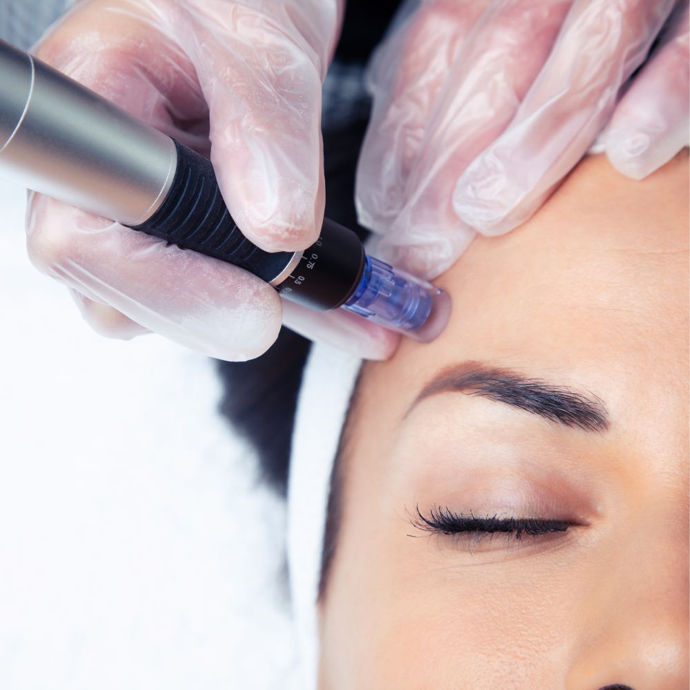Skin Treatments in Floral Park, NY at Jules Aesthetics