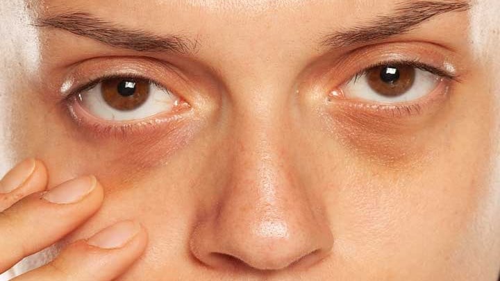 Is Your Face Carrying Extra Baggage?
