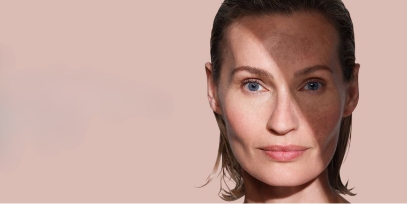 More Than Just A Peel!