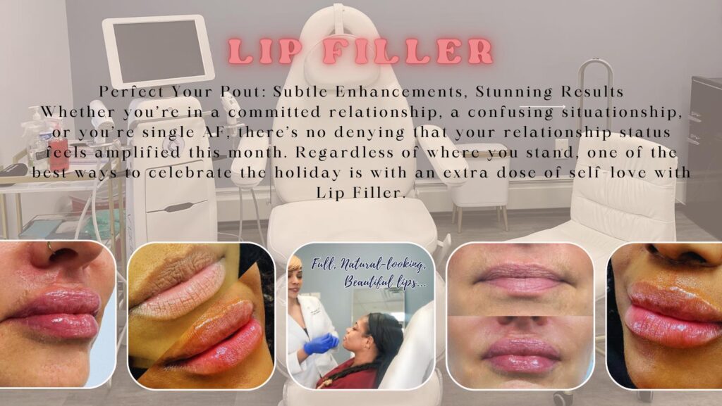 Lip Fillers Before and After results at Jules Aesthetics in Floral Park, NY
