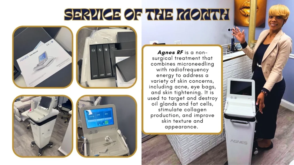 Agnes RF- Service of the month, Jules Aesthetics Announcement