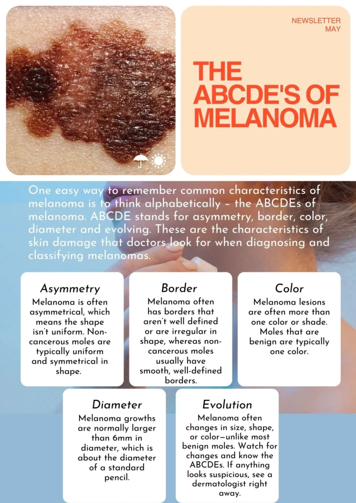Common symptoms of Melanoma | Jules Aesthetics