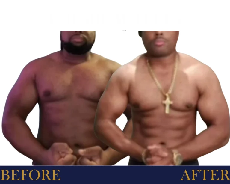 Weight Loss Program Before and After Result- Jules Aesthetics