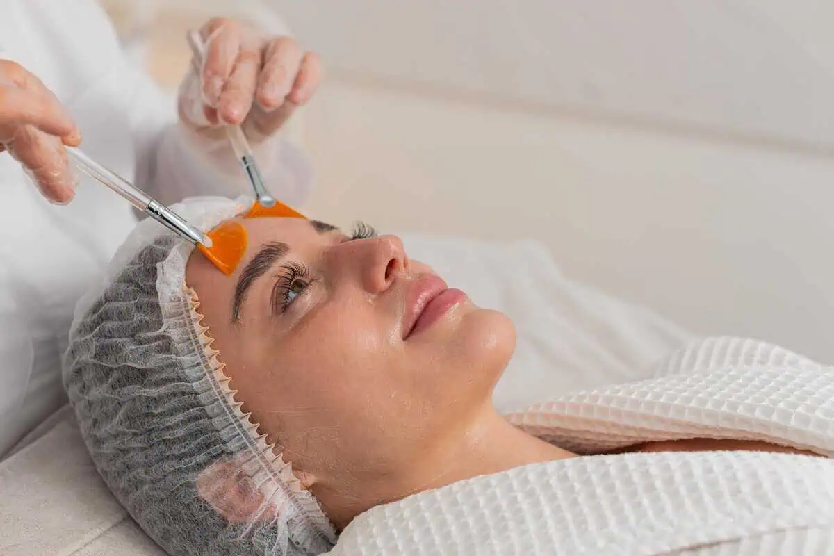 Real Chemical Peel Stories: From Acne Scars to Smooth Skin