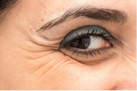 Footprint on My Eyes?!