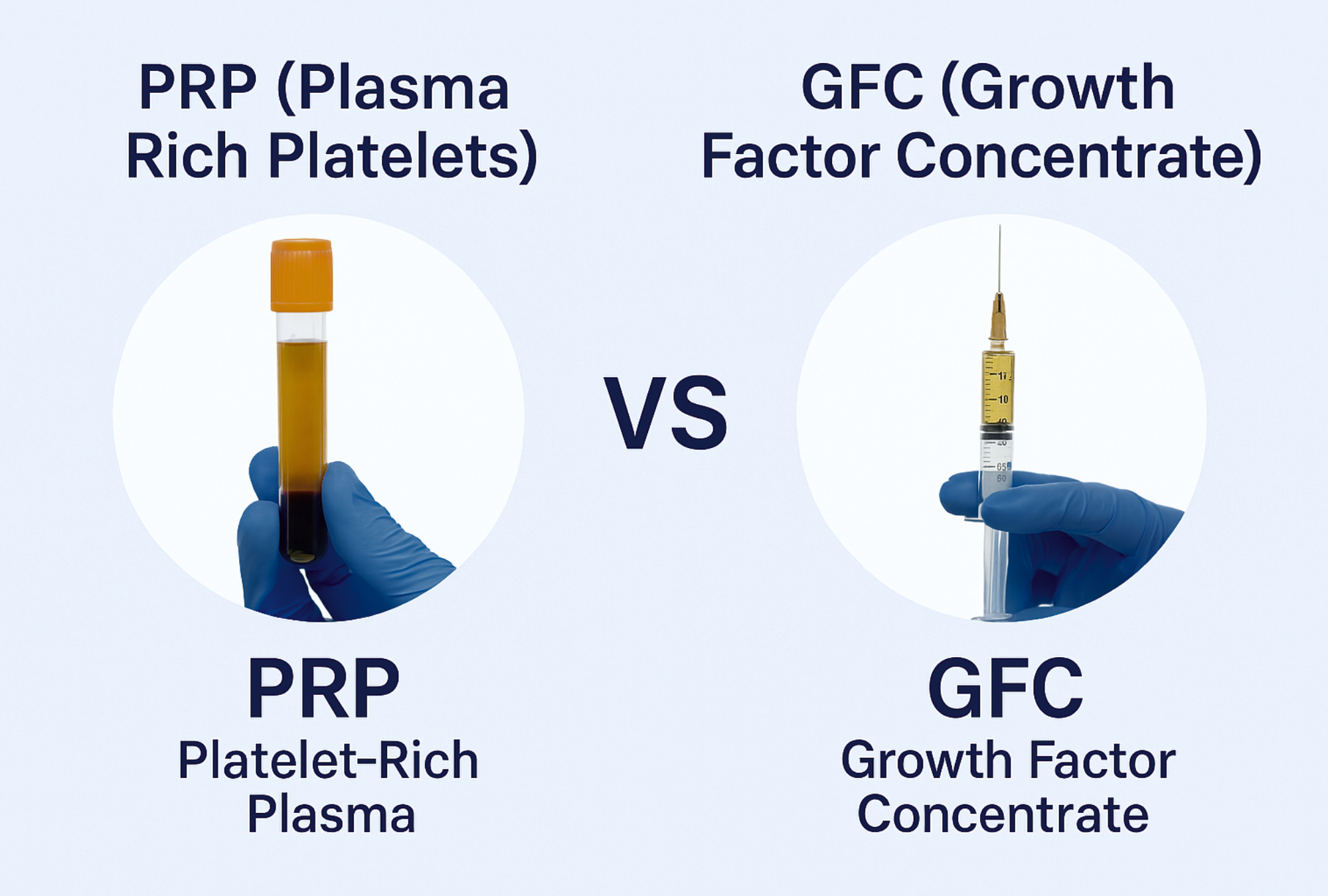 PRP vs GFC Treatment: Which is Better for Hair Regrowth? 